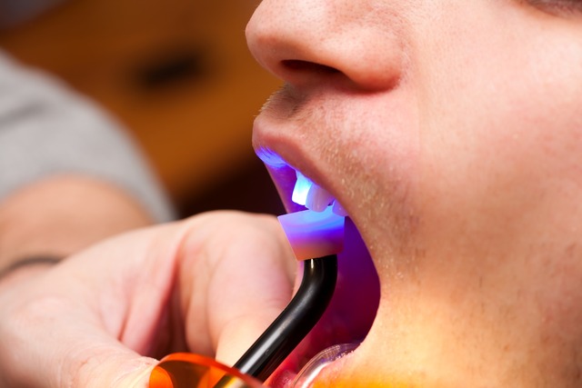 Dental Bonding St Albert